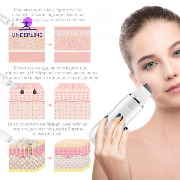 Ультразвуковий скрабер для чищення обличчя омолодження шкіри ліфтингу та фонофорезу Ultrasonic Scrubber W-1188 AC013 фото