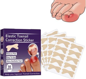 Набір пластирів Elastic Toenail Correction Sticker для корекції та усунення врослих нігтів (50 шт.) PT17 фото