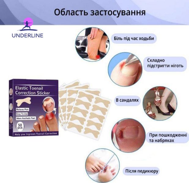 Набір пластирів Elastic Toenail Correction Sticker для корекції та усунення врослих нігтів (50 шт.) PT17 фото