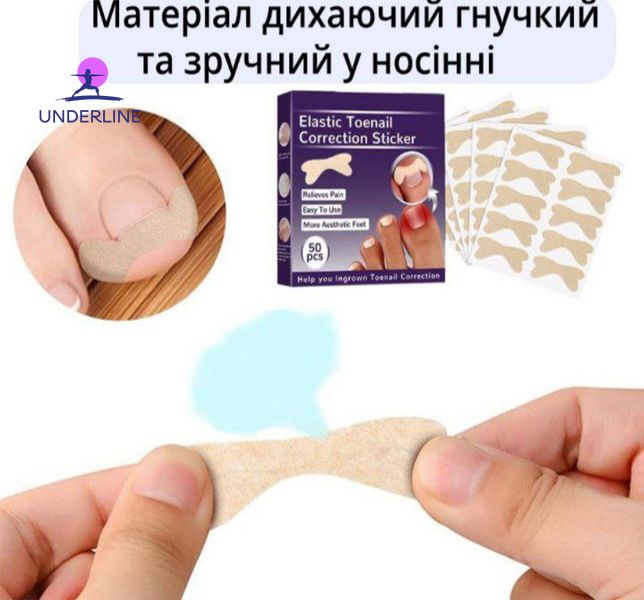 Набор пластырей Elastic Toenail Correction Sticker для коррекции и устранения вросших ногтей (50 шт.) PT17 фото