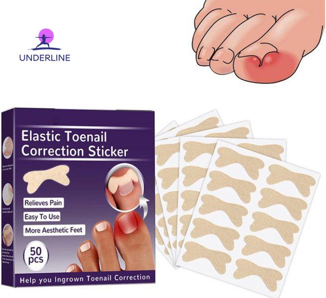 Набор пластырей Elastic Toenail Correction Sticker для коррекции и устранения вросших ногтей (50 шт.) PT17 фото