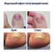 Набір пластирів Elastic Toenail Correction Sticker для корекції та усунення врослих нігтів (50 шт.) PT17 фото 2